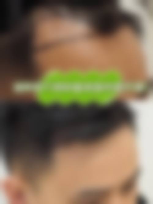 八、泰州百年植发医疗美容诊所怎么预约?