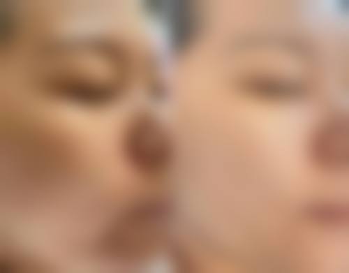 六、唐山遵化整形医疗美容诊所(唐山金荣医院遵化分部)口碑如何?