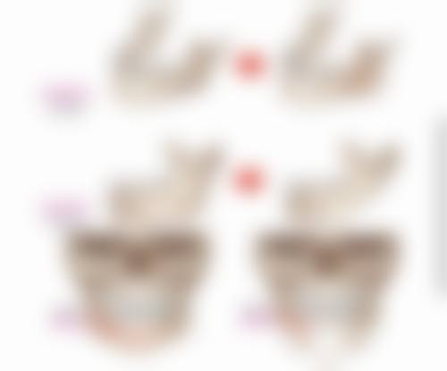 四、韩国德美特整形医院特色项目