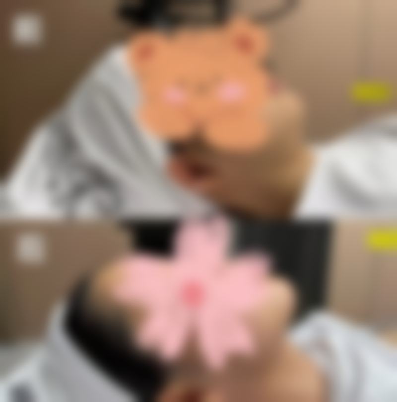 超声波吸眼袋