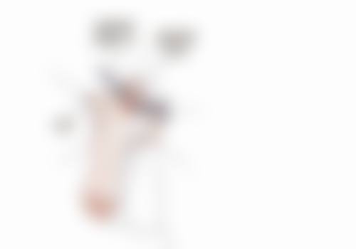 激光治疗疤痕增生的成效评估