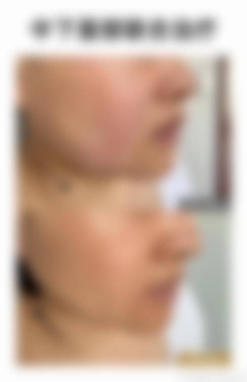 八、深圳幸福整形美容医院怎么预约?