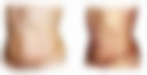 疤痕擦什么药膏不留疤？不同类型疤痕适用不同药膏，硅酮凝胶等助您科学祛疤！ 