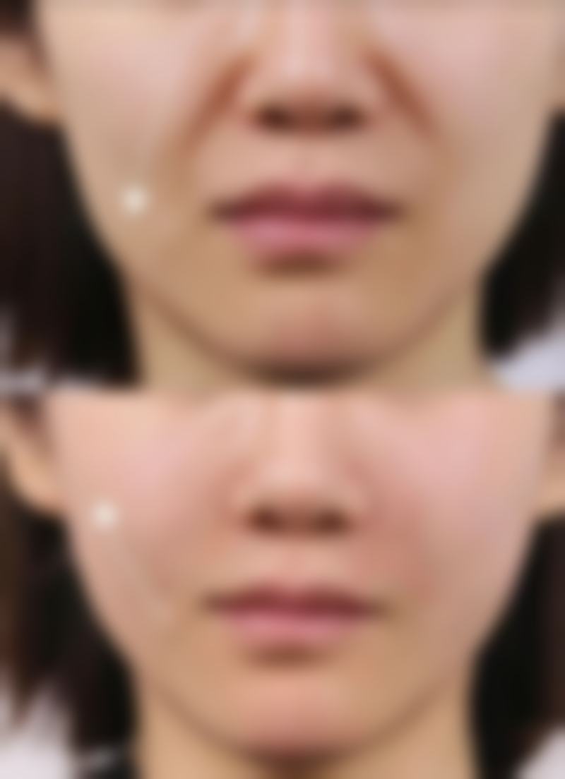 术后同房的注意事项