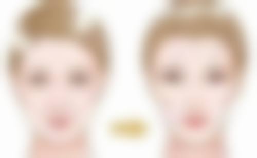 做内切眼袋导致眼睛凹陷的原因