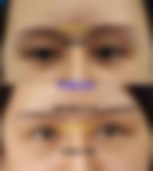 五、韩国美Q美容整形外科收费价格表