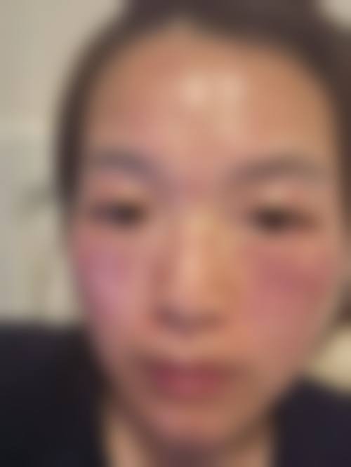 五、第二军 医 大学长征医院南京分院皮肤激光美容中 心收费价格表