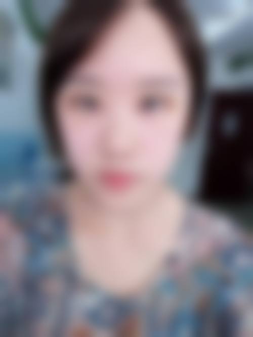 六、无锡星悦整形医院口碑如何?