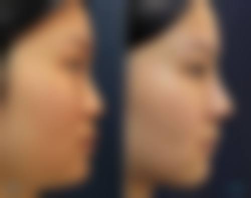 七、兰州圣莫丽斯整形医疗美容医院地址电话及营业时间