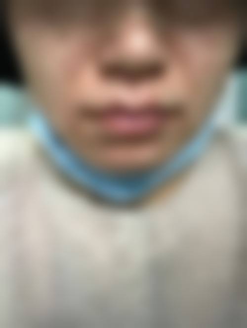 六、宁波鄞州孵美整形医院口碑如何?
