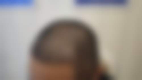四、湖州同济医疗美容门诊部特色项目