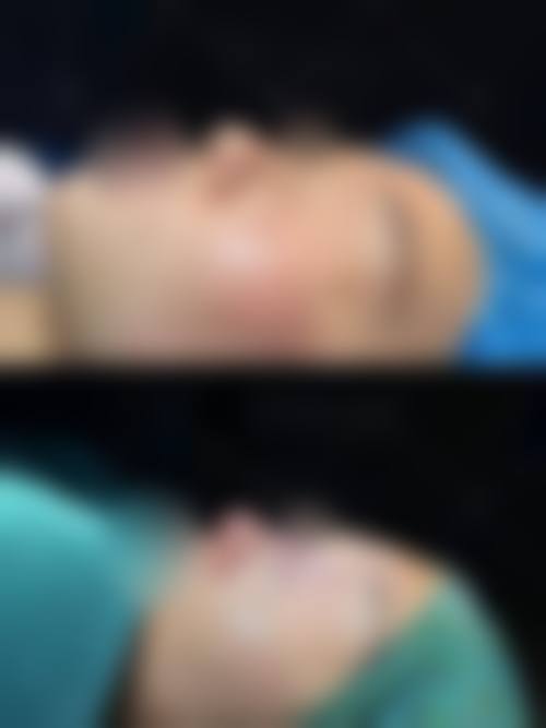 八、涿州高歌溢美整形医院怎么预约?