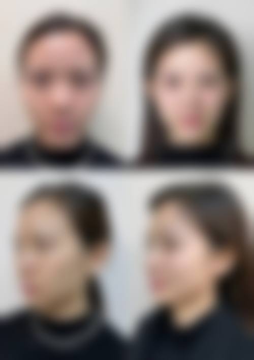 五、深圳壹倍尔医疗美容诊所收费价格表