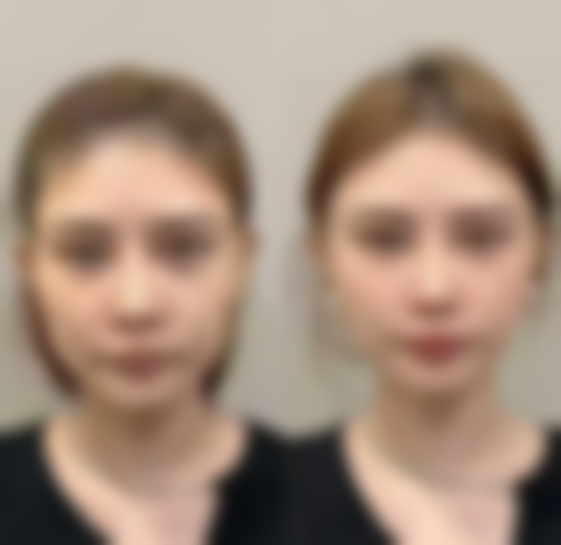 六、长沙荪臻臻医疗美容门诊部口碑如何?