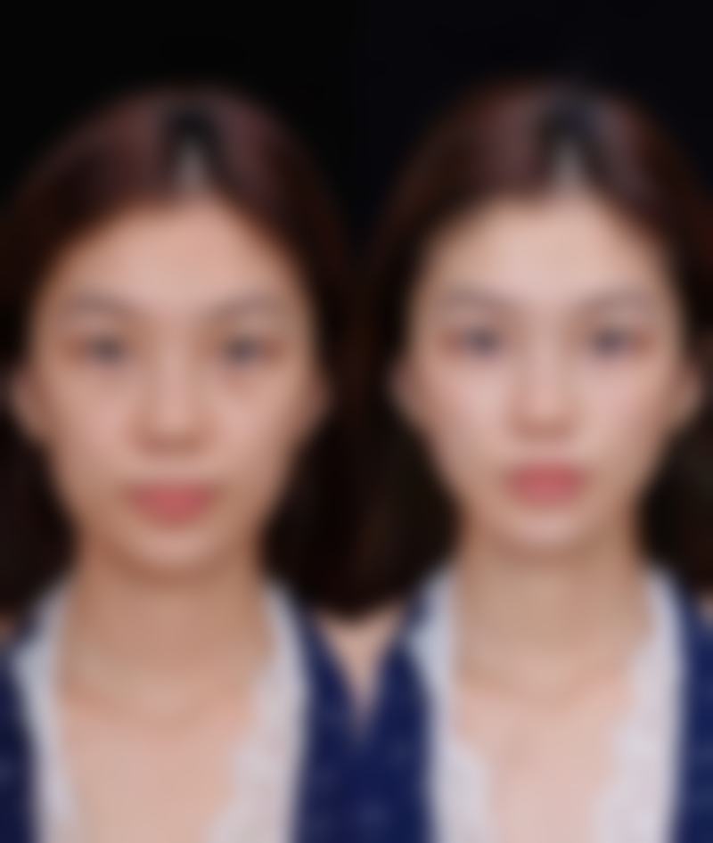 四、长沙荪臻臻医疗美容门诊部特色项目