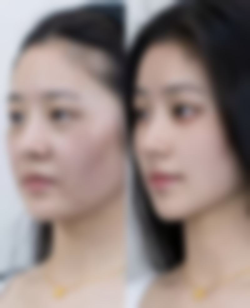 八、长沙荪臻臻医疗美容门诊部怎么预约?