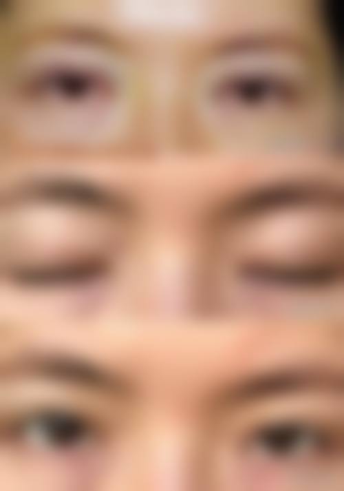 六、郑州兰茜整形医院口碑如何？