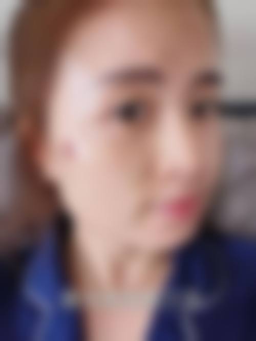 四、曲靖市妇幼保健院皮肤美容科特色项目