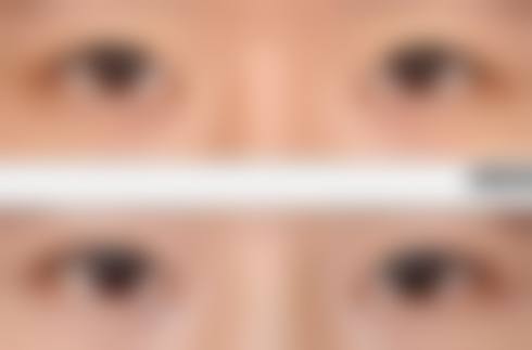 七、郑州兰茜整形医院地址电话及营业时间