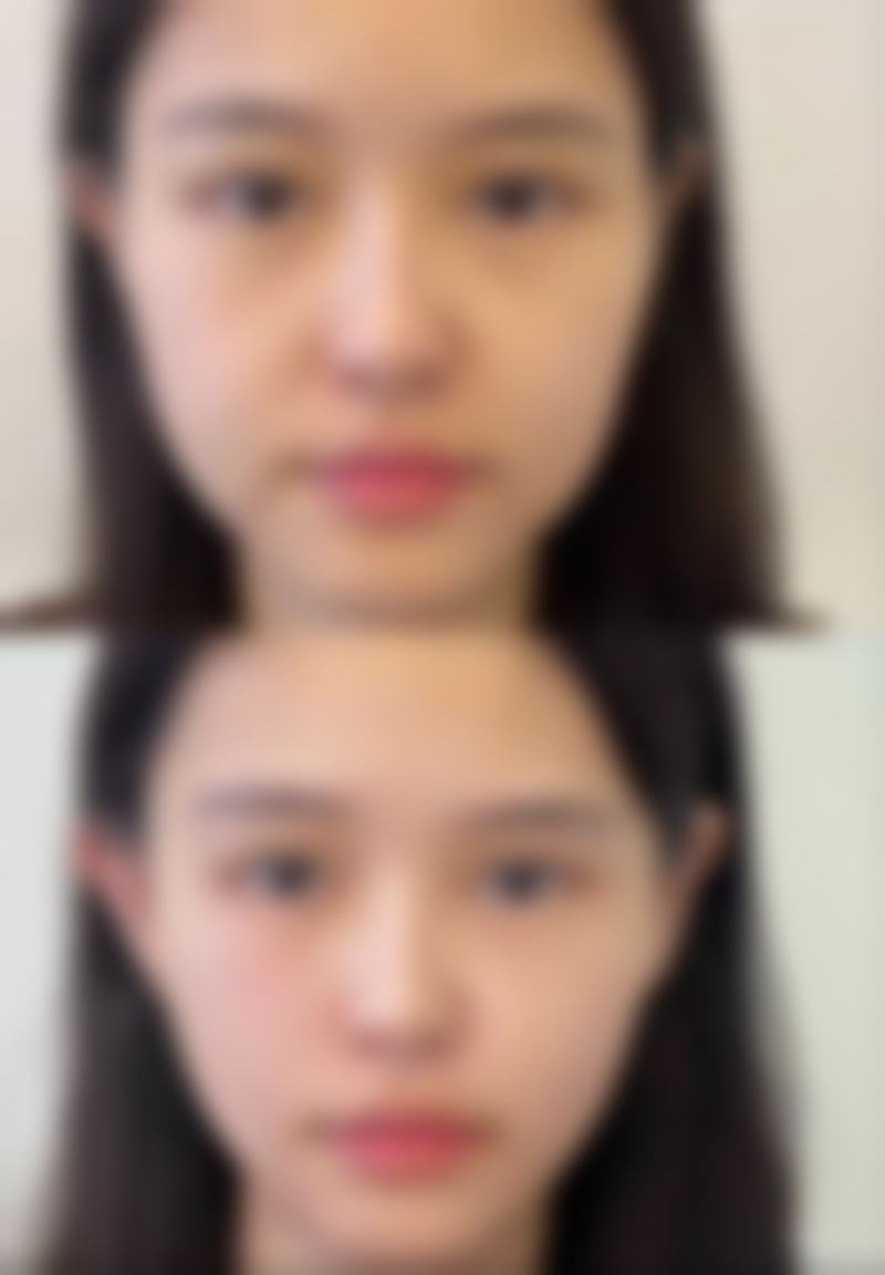 八、曲靖市妇幼保健院皮肤美容科怎么预约?