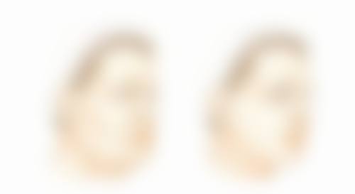 日常护理不可忽视