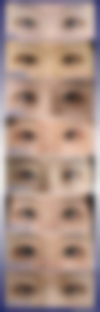 四、太原美诗恩医疗美容诊所特色项目