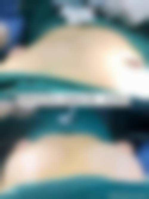 六、画廊galleryprs整形医院口碑如何?