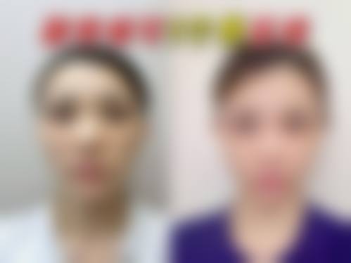 四、呼和浩特市闫小林医疗美容门诊部特色项目