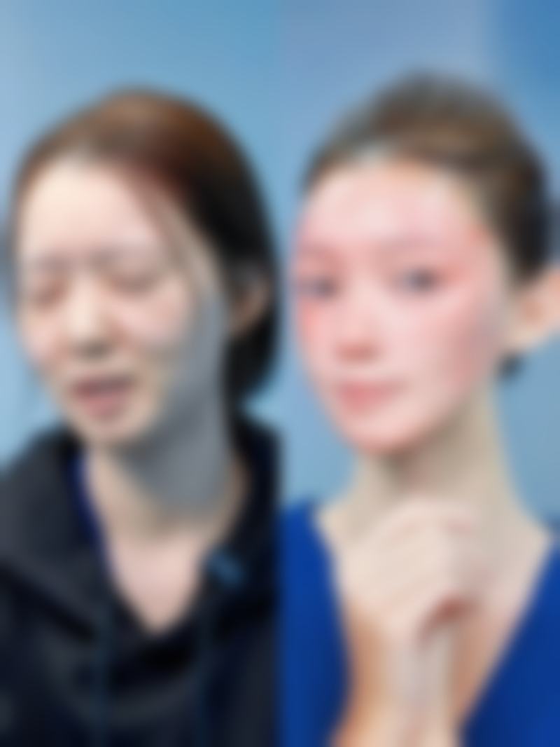 五、荆州星月汇医疗美容覃炎锋医生技术怎么样?