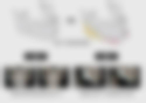 其他因素致使双眼皮变三眼皮