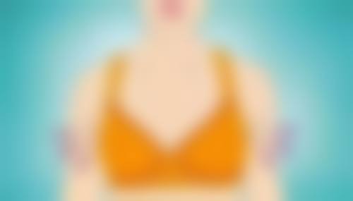 手术方法实现单眼皮变双眼皮