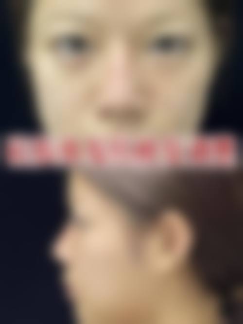 八、上海苇渡门诊部整形科怎么预约？
