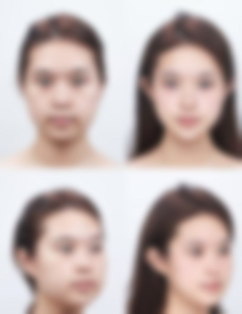 五、郑州芳华医疗美容门诊部收费价格表