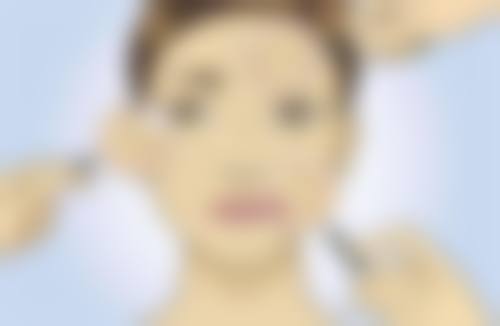 二、上海中瀛医疗美容张缘医生擅长项目