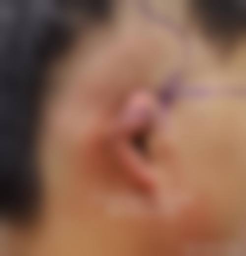 六、湖南长沙迦美医疗美容口碑如何？