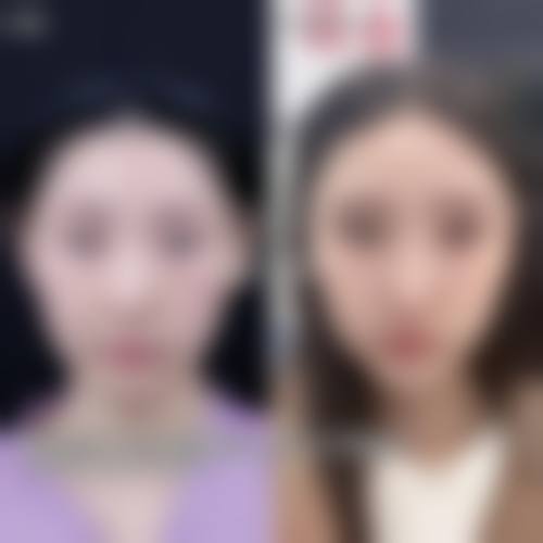 五、深圳幸福医疗美容门诊部收费价格表