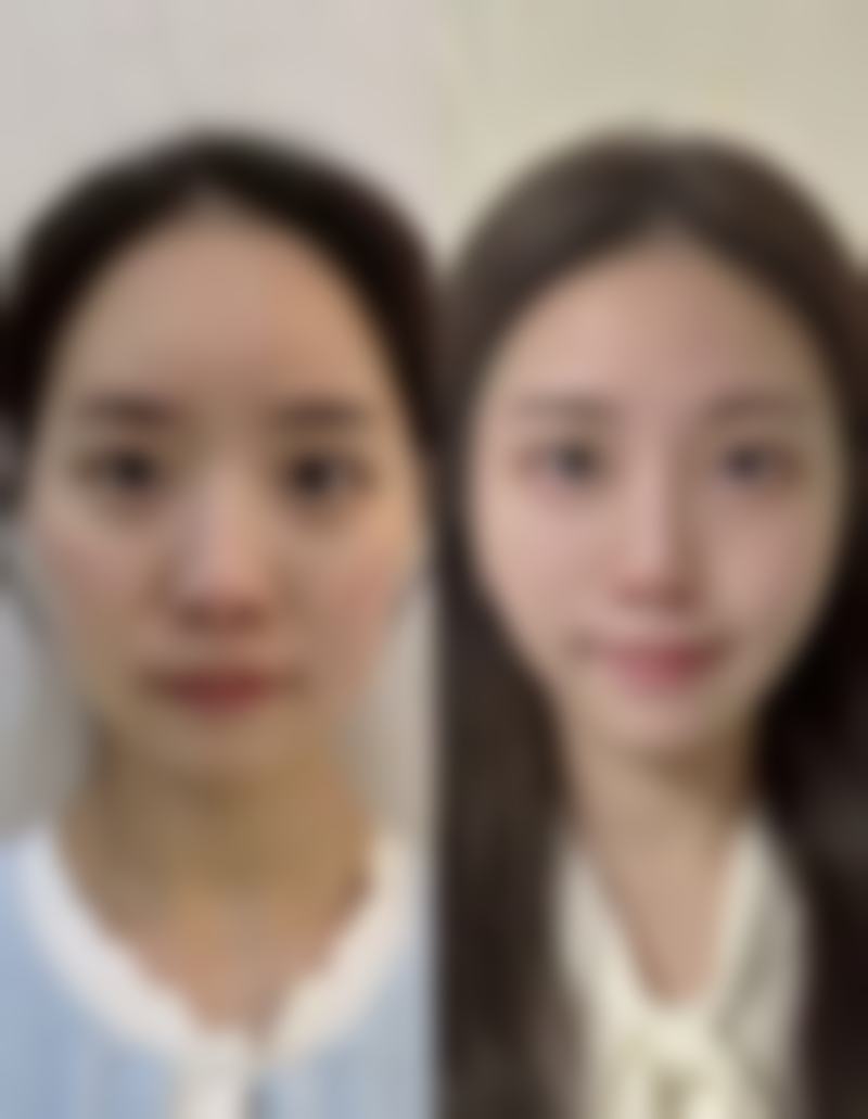 审美偏好与双眼皮的搭配