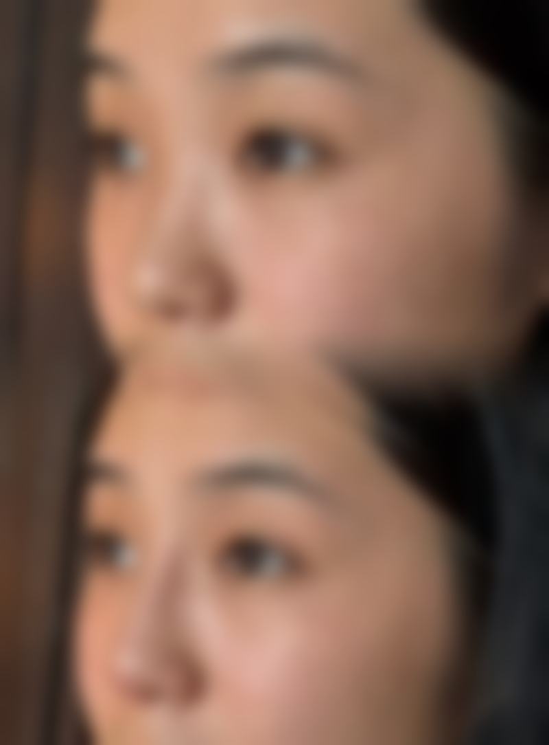 面诊前的准备