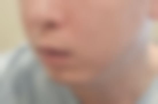首尔特别市医美医院收费价格一览表，韩国TS整形各项目收费详情及优质服务全揭秘！ 