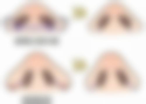 物理治疗改善眼袋