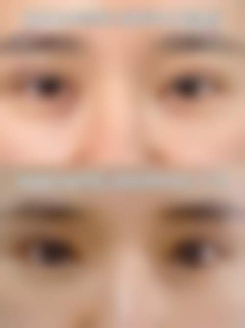 七、北京美雅枫李晓曦医生怎么预约?