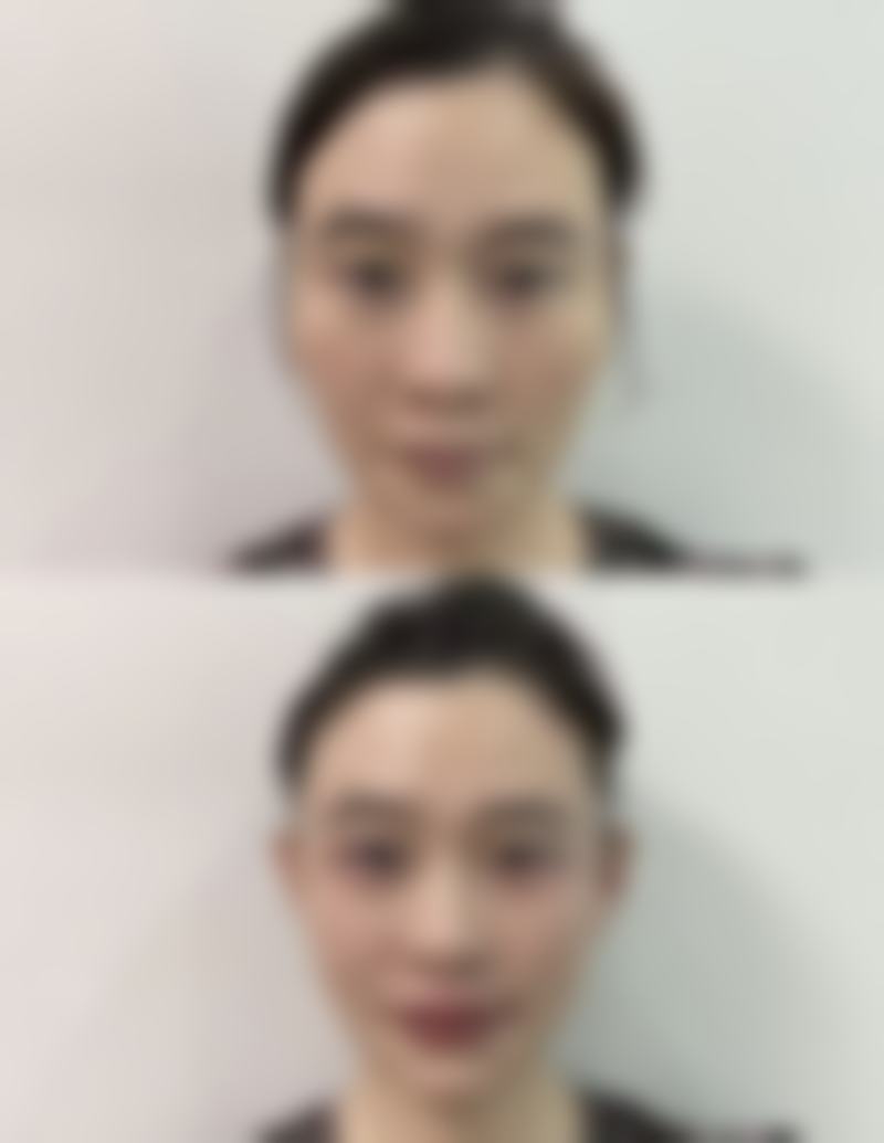 结合个人修复情况确定化妆时间