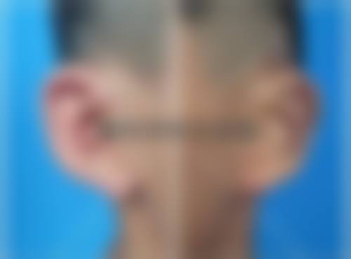 六、北京玛丽整形医院口碑如何?