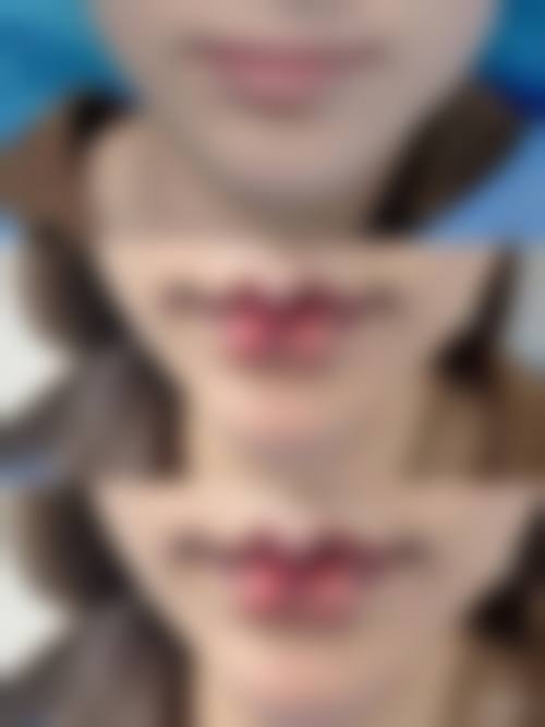 六、贵阳美杜莎元辰整形医疗美容门诊部口碑如何?