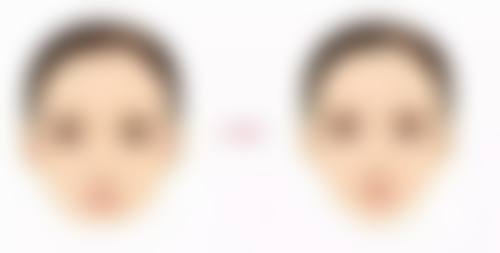 五、广州铂医昂方郝铁英医生技术怎么样？
