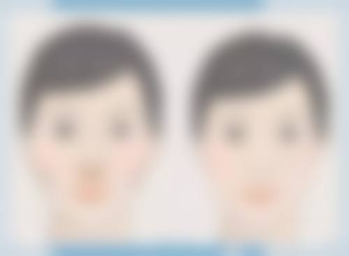 金容主医生擅长项目