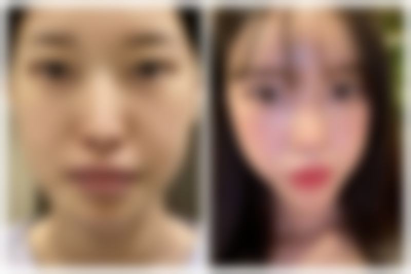 五、成都美瑞皮肤医疗美容机构收费价格表