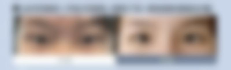 多少岁隆胸是最佳时间？其实没有绝对答案，一般18岁后结合多因素综合评估才是关键！ 