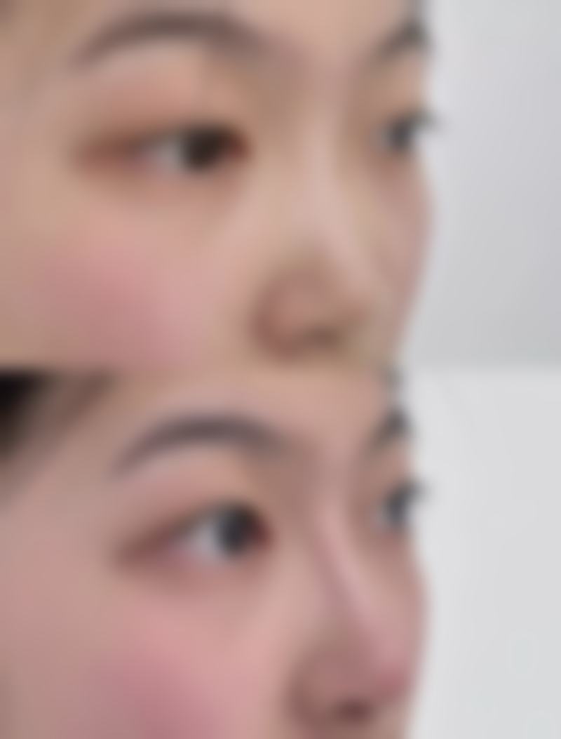 四、南宁瑞心莱思整形医院特色项目