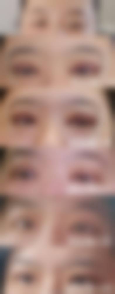 五、龙口壹美整形美容医院收费价格表